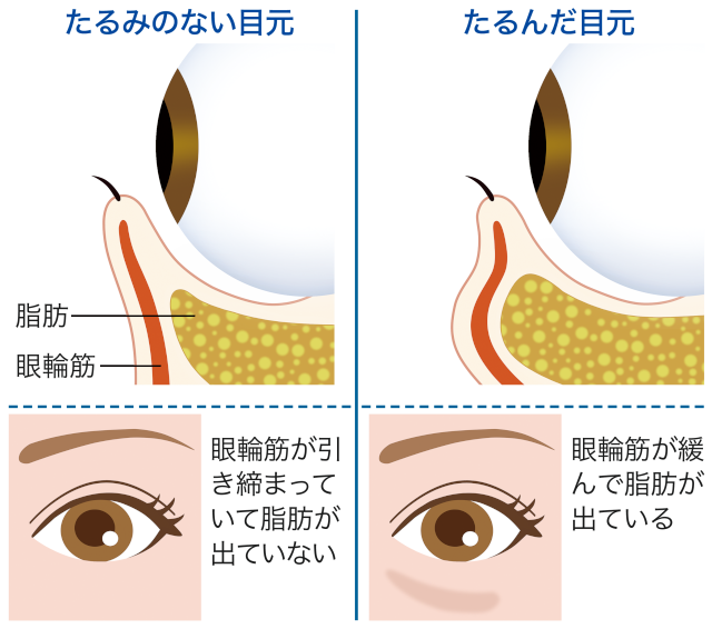 眼輪筋がゆるむ